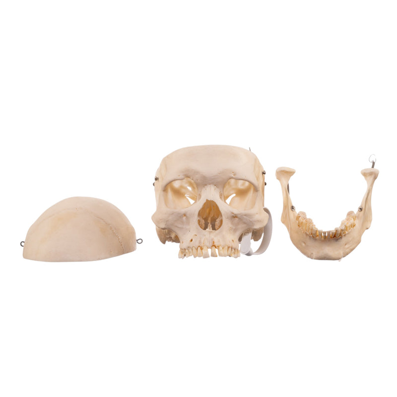 Real Human Skeleton - Disarticulated