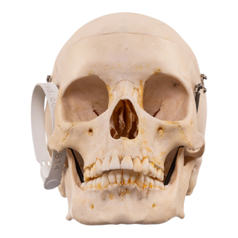 Real Human Half Skeleton