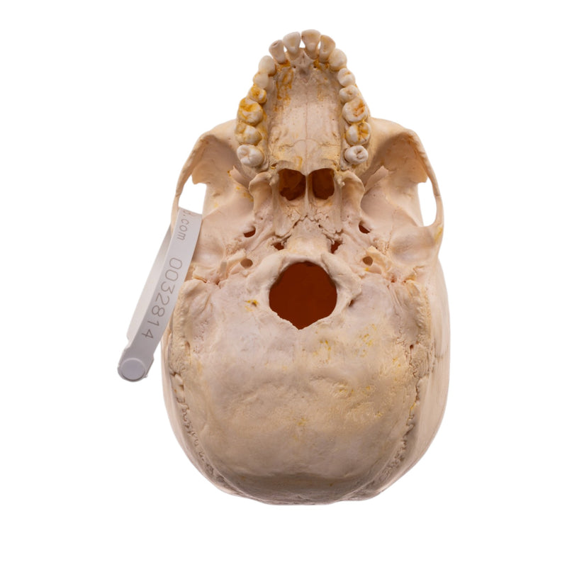 Real Human Half Skeleton