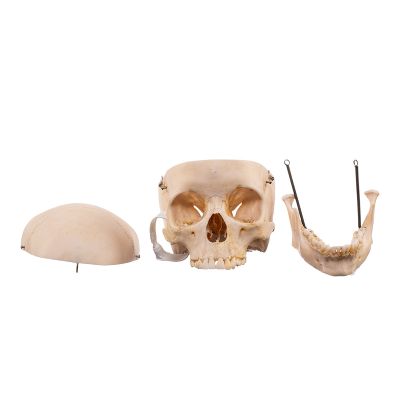 Real Human Half Skeleton