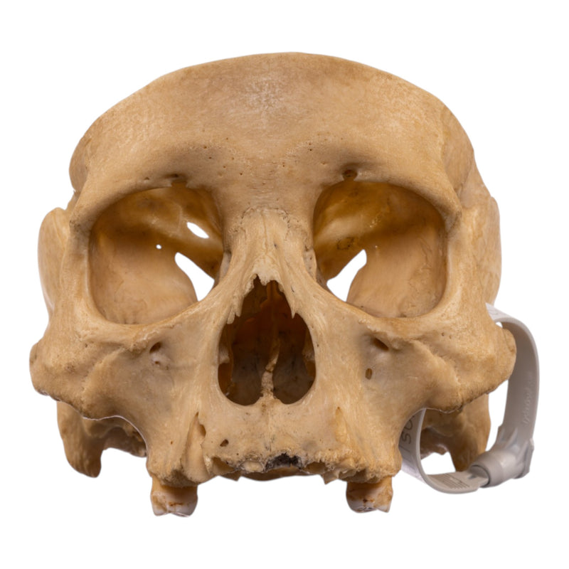 Real Human Partial Skull