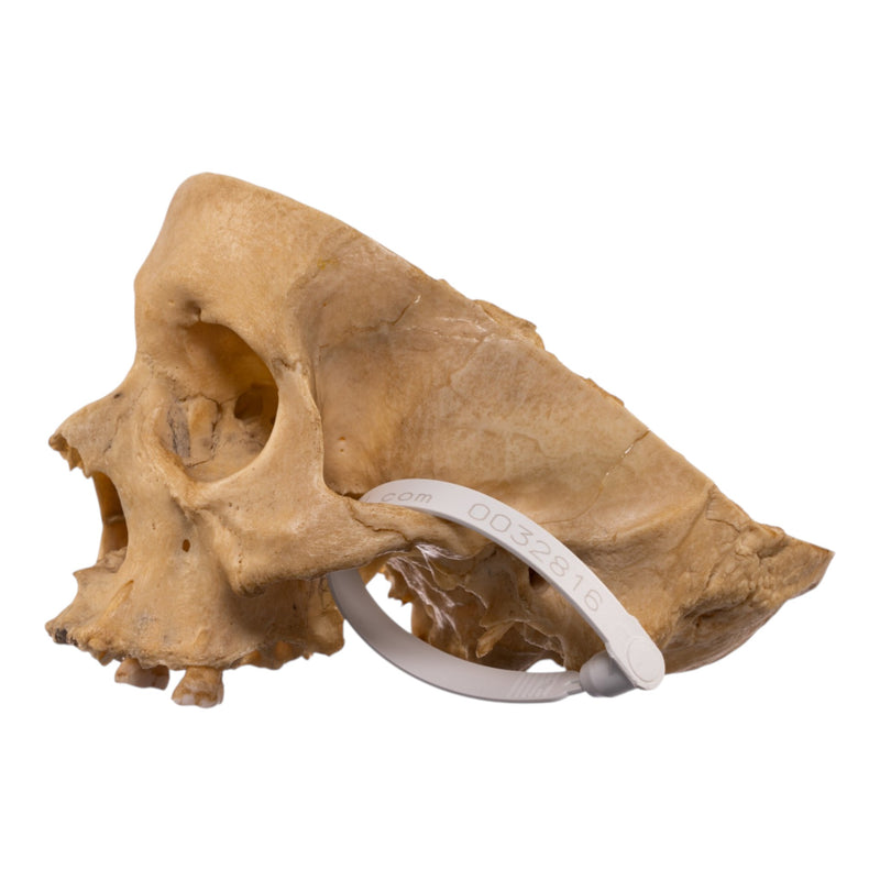 Real Human Partial Skull