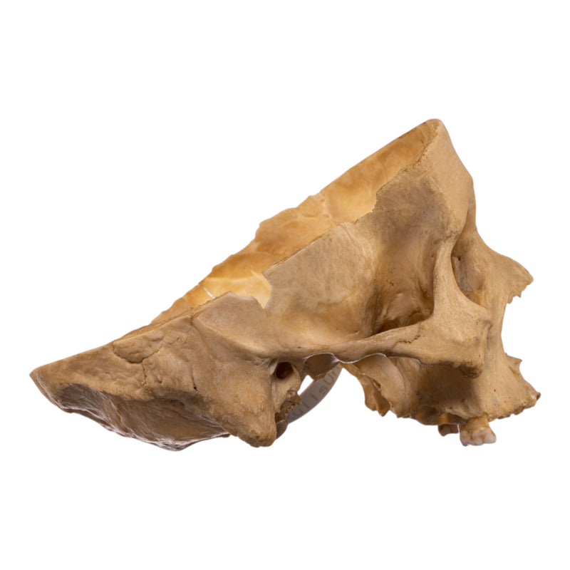 Real Human Partial Skull