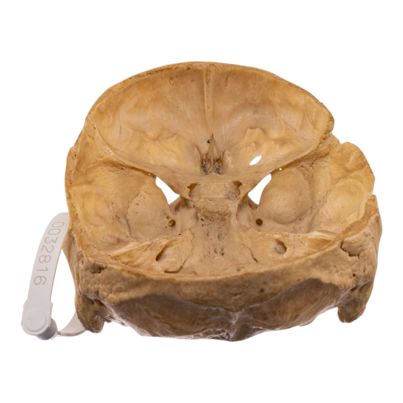 Real Human Partial Skull