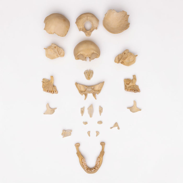 Real Human Skull Disarticulated with Case