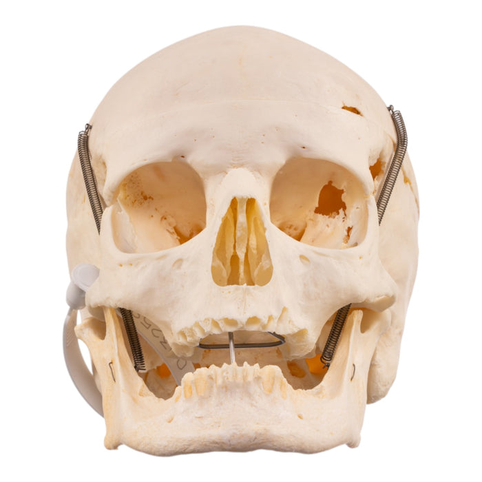 Real Human Skull