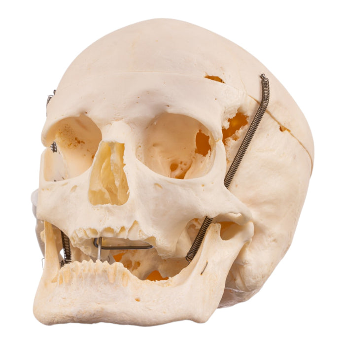 Real Human Skull