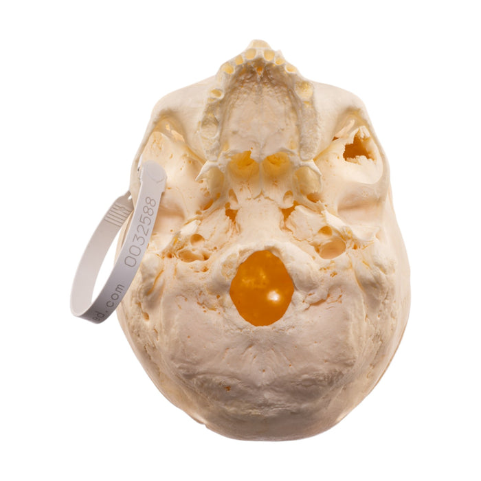 Real Human Skull