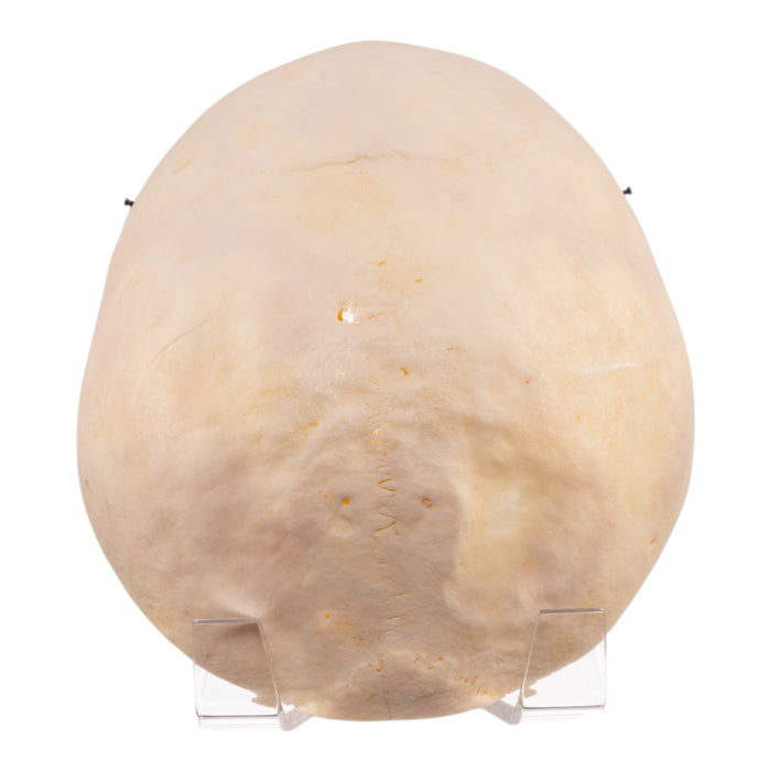 Real Human Skull