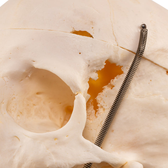 Real Human Skull