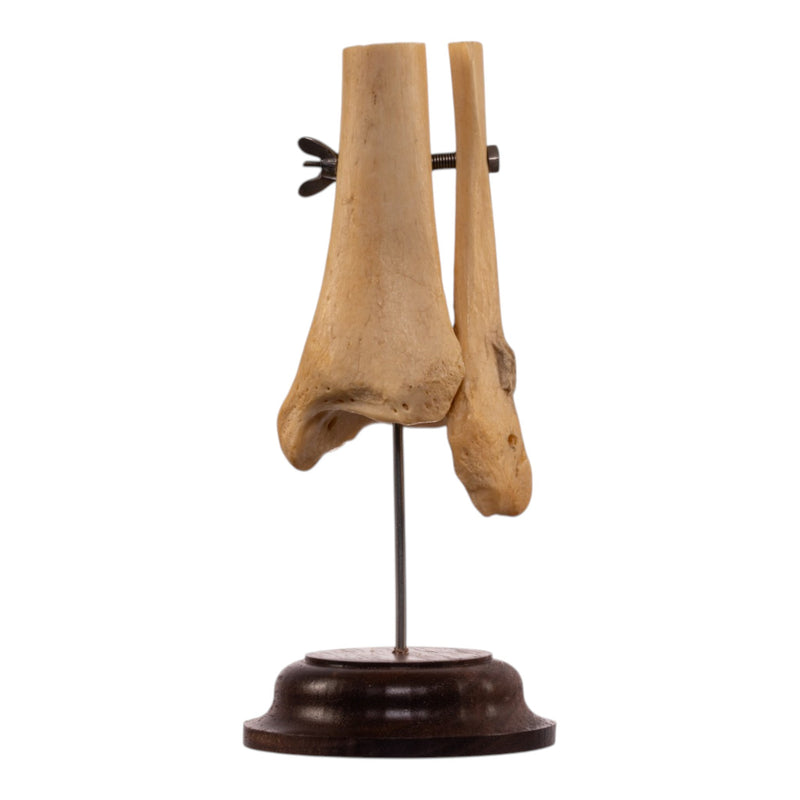 Real Human Partial Tibia and Fibula on Stand