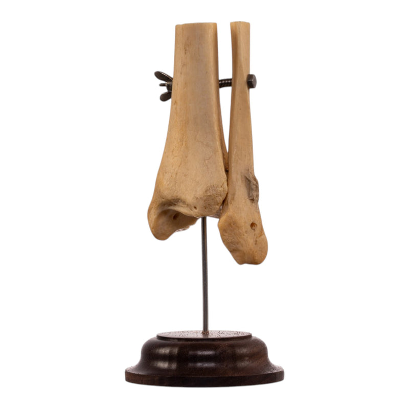 Real Human Partial Tibia and Fibula on Stand
