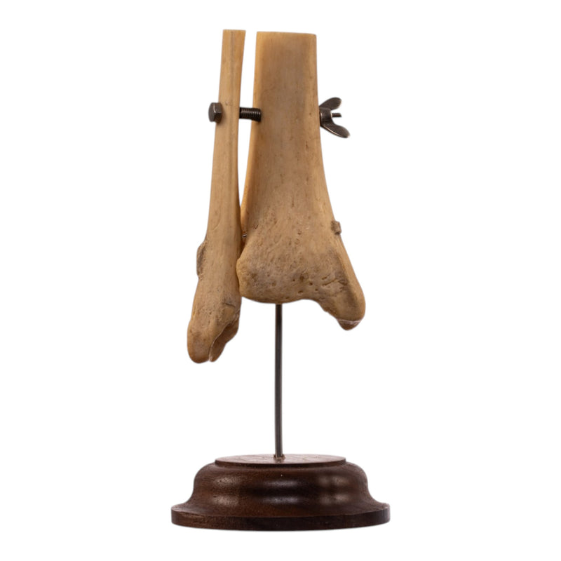 Real Human Partial Tibia and Fibula on Stand