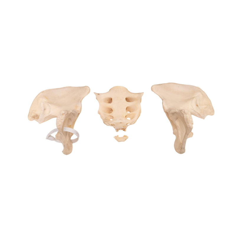 Real Human Pelvis and Sacrum - Disarticulated