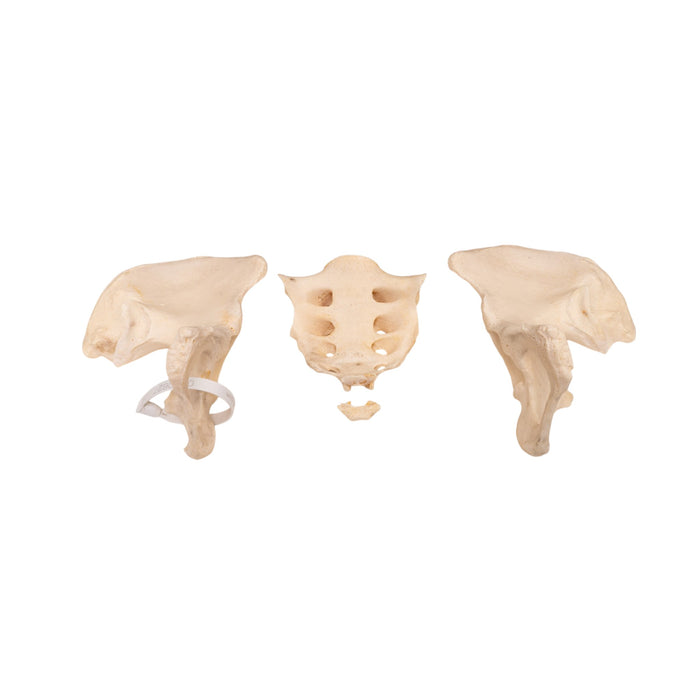 Real Human Pelvis and Sacrum - Disarticulated