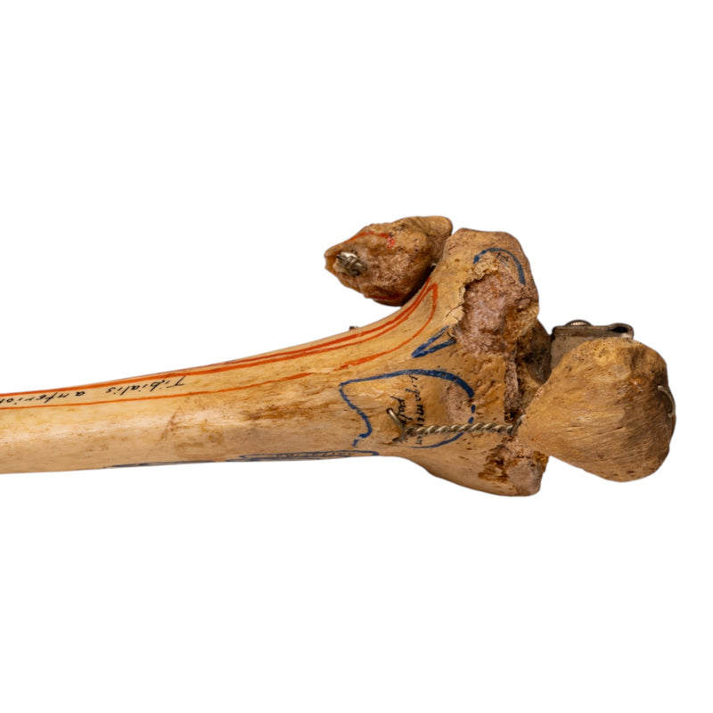 Real Human Right Partial Leg - Articulated