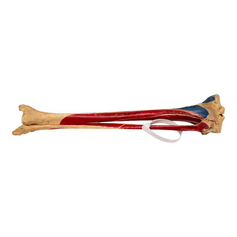 Real Human Tibia and Fibula - Painted