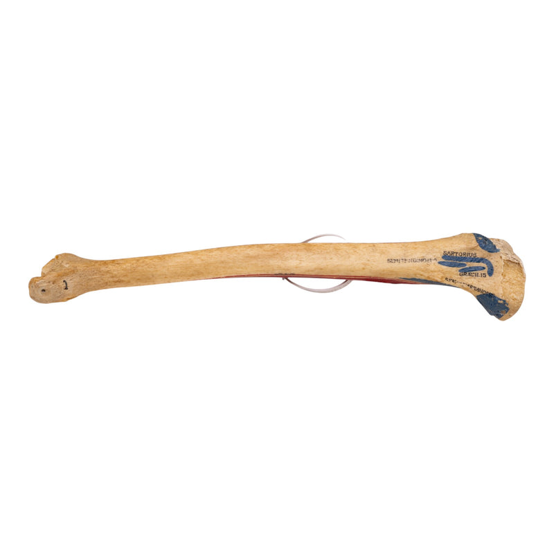 Real Human Tibia and Fibula - Painted