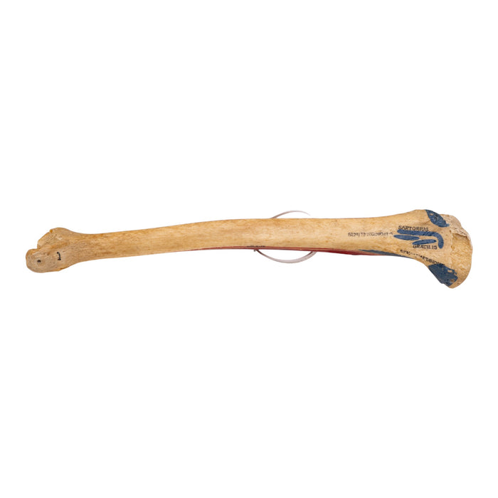 Real Human Tibia and Fibula - Painted