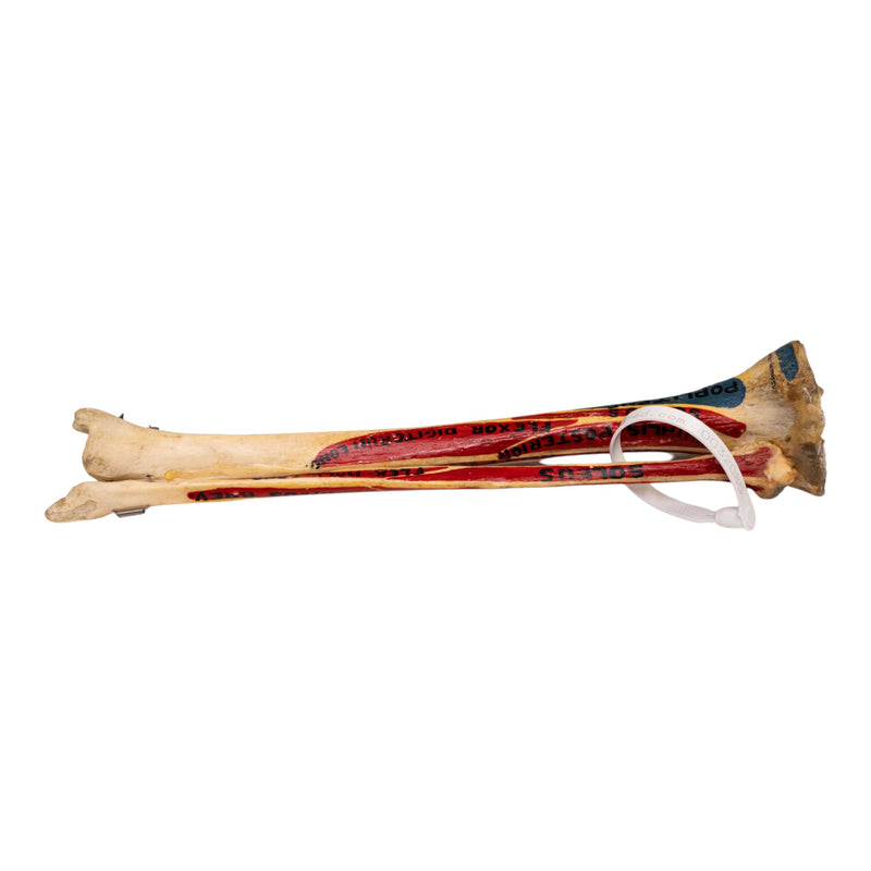 Real Human Tibia and Fibula - Painted