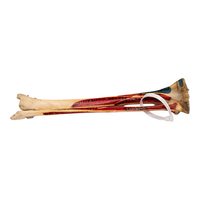 Real Human Tibia and Fibula - Painted
