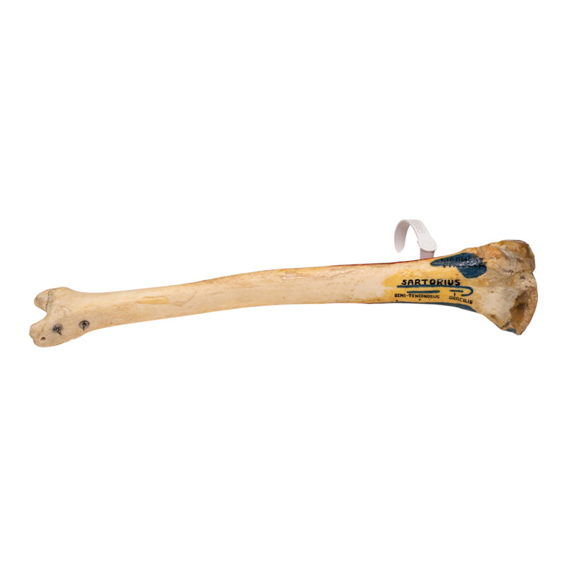 Real Human Tibia and Fibula - Painted