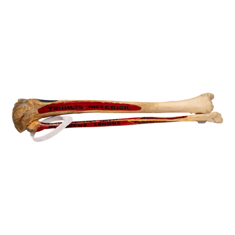 Real Human Tibia and Fibula - Painted