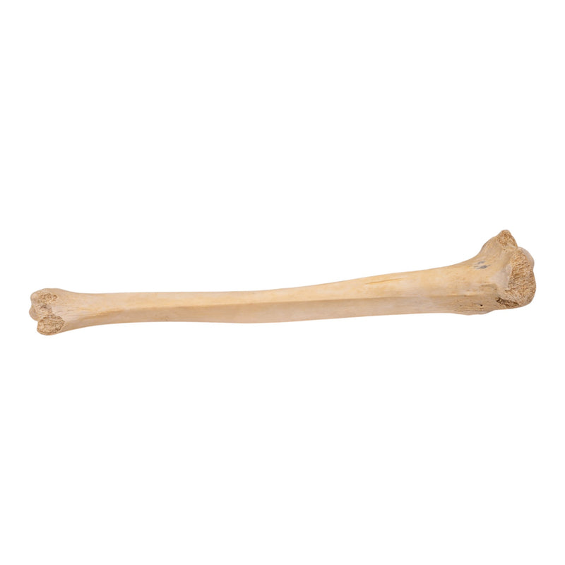 Real Human Tibia - Pathology