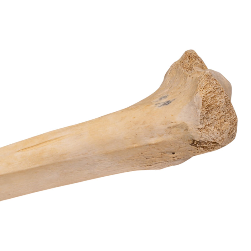 Real Human Tibia - Pathology