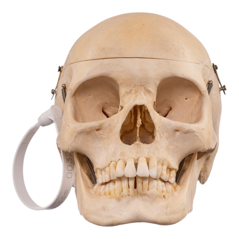 Real Human Composite Skeleton - Disarticulated