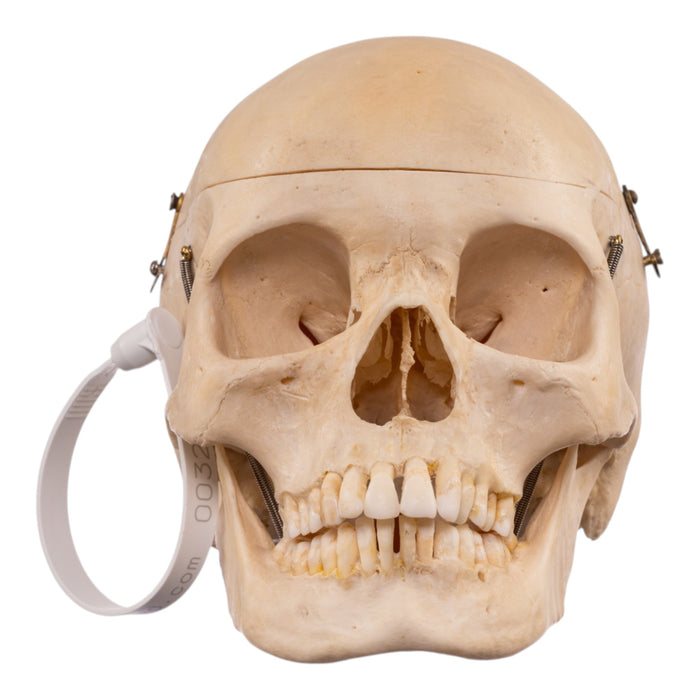 Real Human Composite Skeleton - Disarticulated