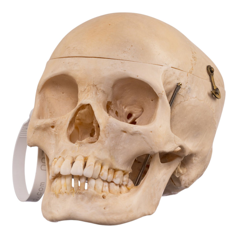 Real Human Composite Skeleton - Disarticulated