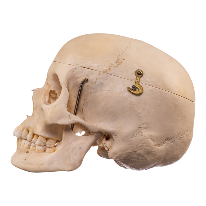 Real Human Composite Skeleton - Disarticulated