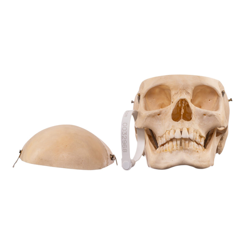 Real Human Composite Skeleton - Disarticulated