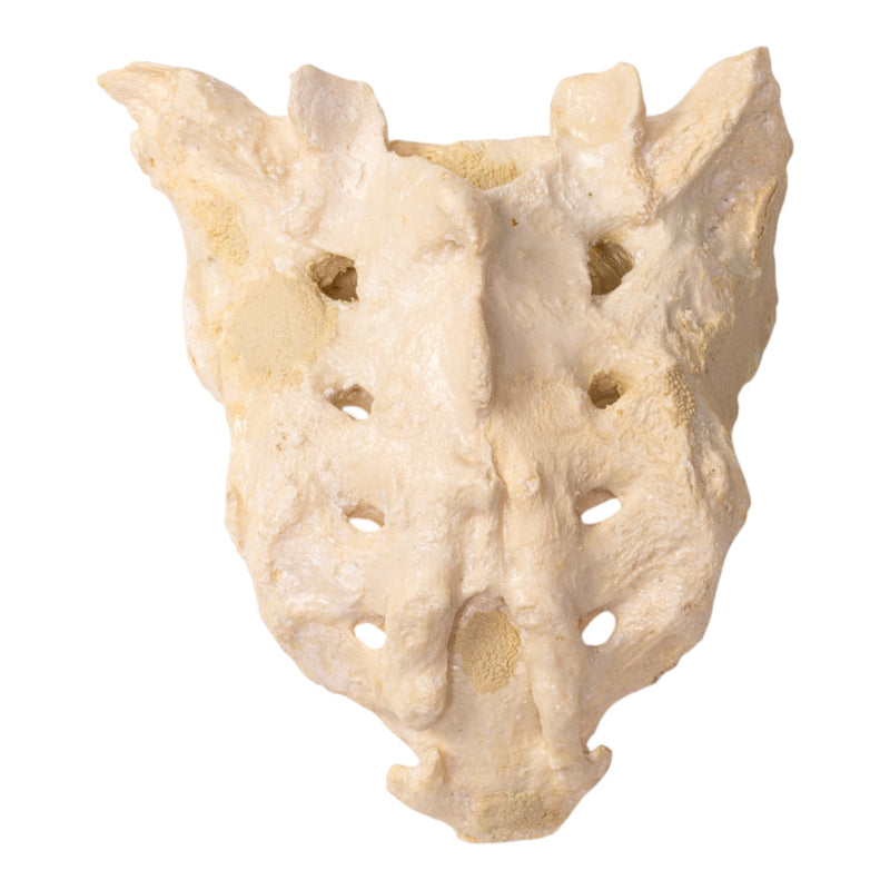 Real Human Spine and Sacrum