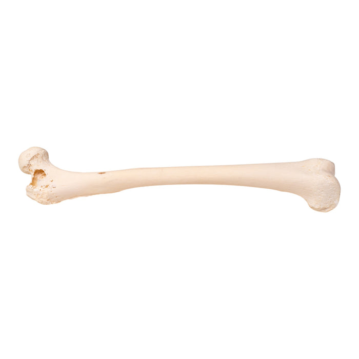Real Human Femur - Pathology