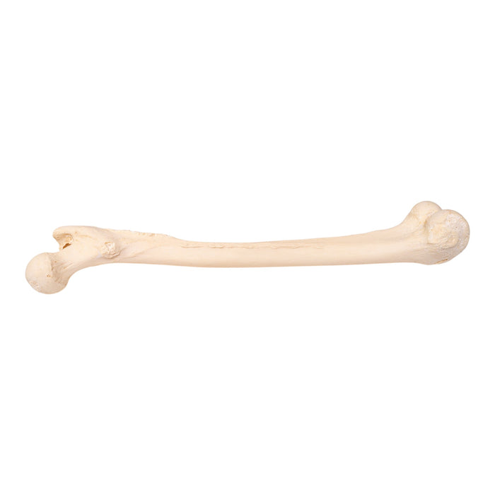 Real Human Femur - Pathology