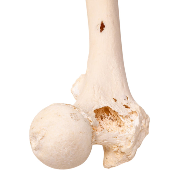 Real Human Femur - Pathology