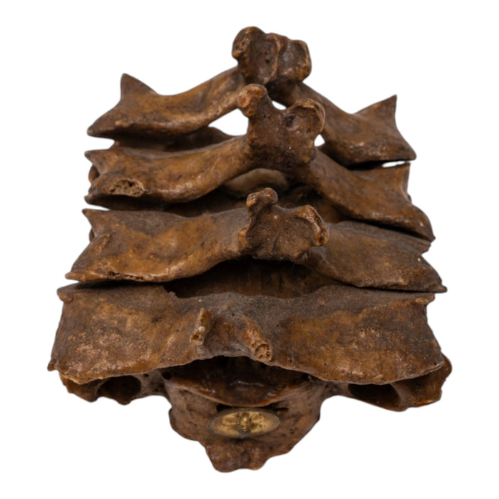 Real Human Vertebrae Set