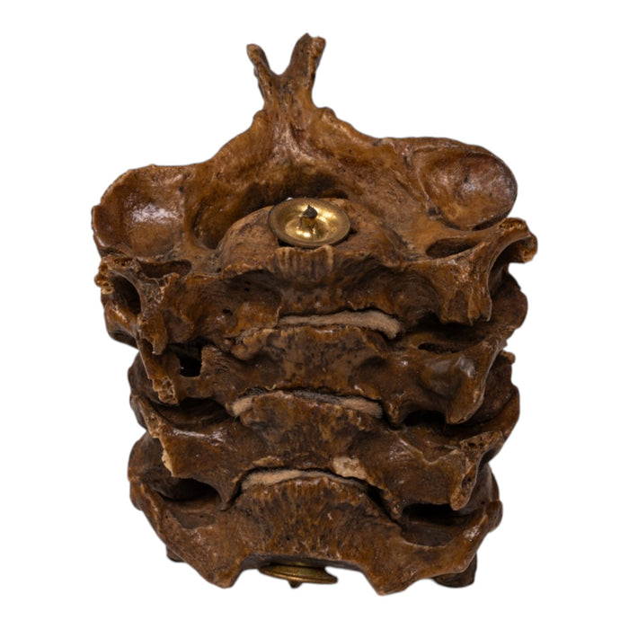 Real Human Vertebrae Set