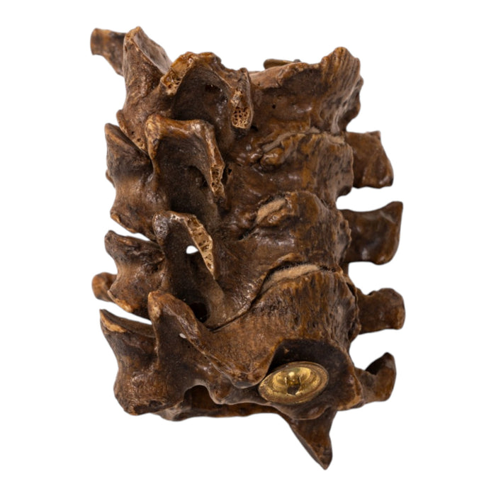 Real Human Vertebrae Set