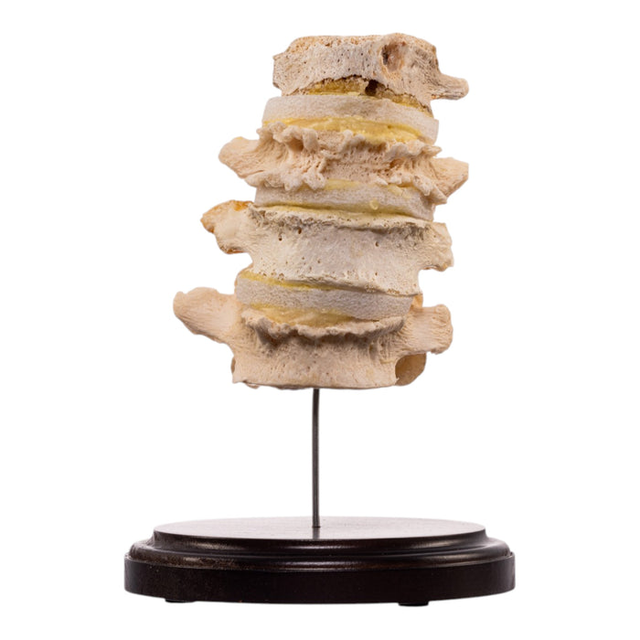 Real Human Vertebrae Set
