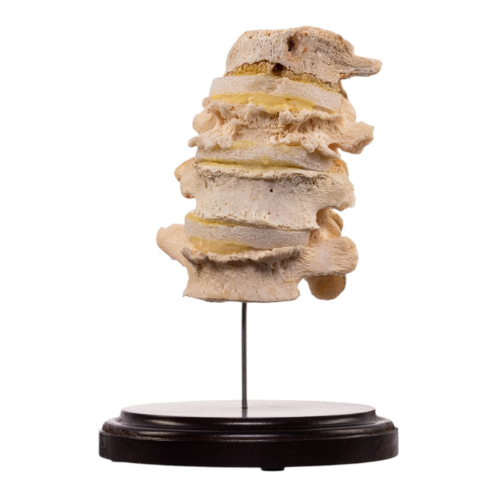Real Human Vertebrae Set