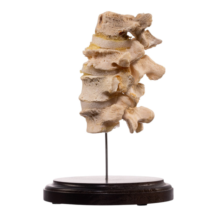 Real Human Vertebrae Set