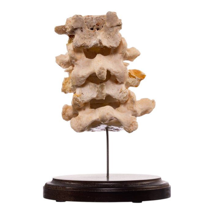 Real Human Vertebrae Set