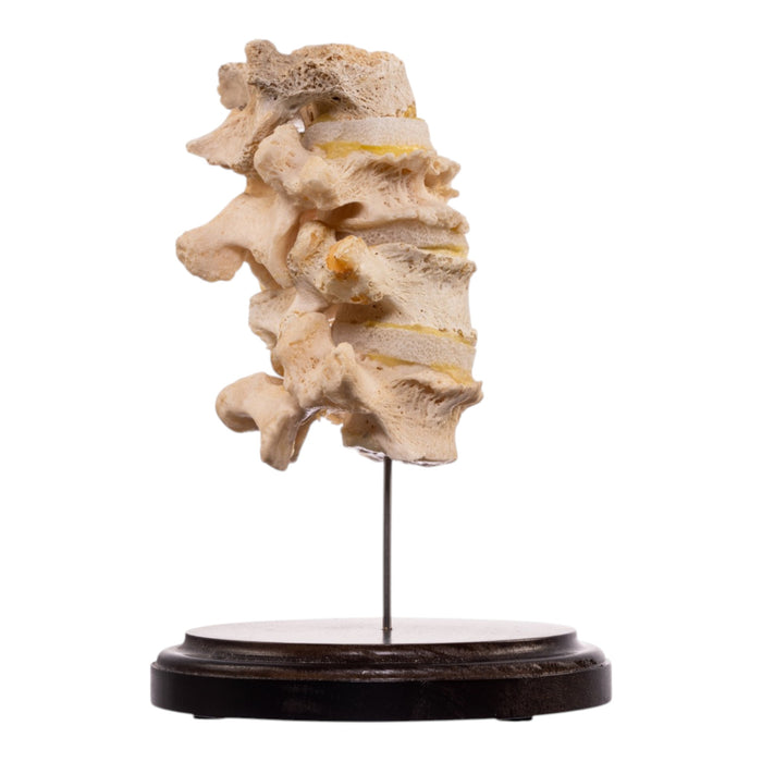 Real Human Vertebrae Set