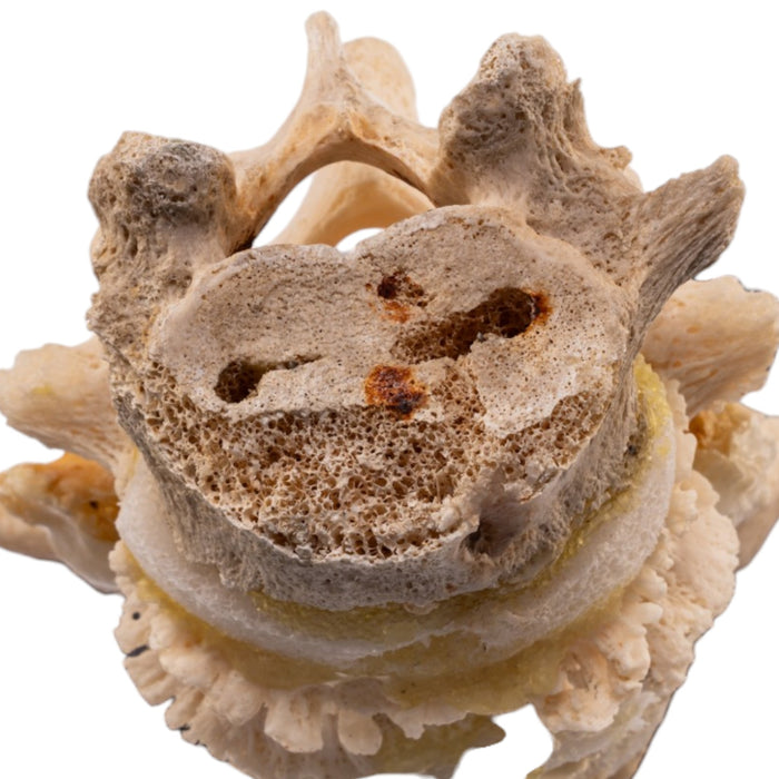 Real Human Vertebrae Set