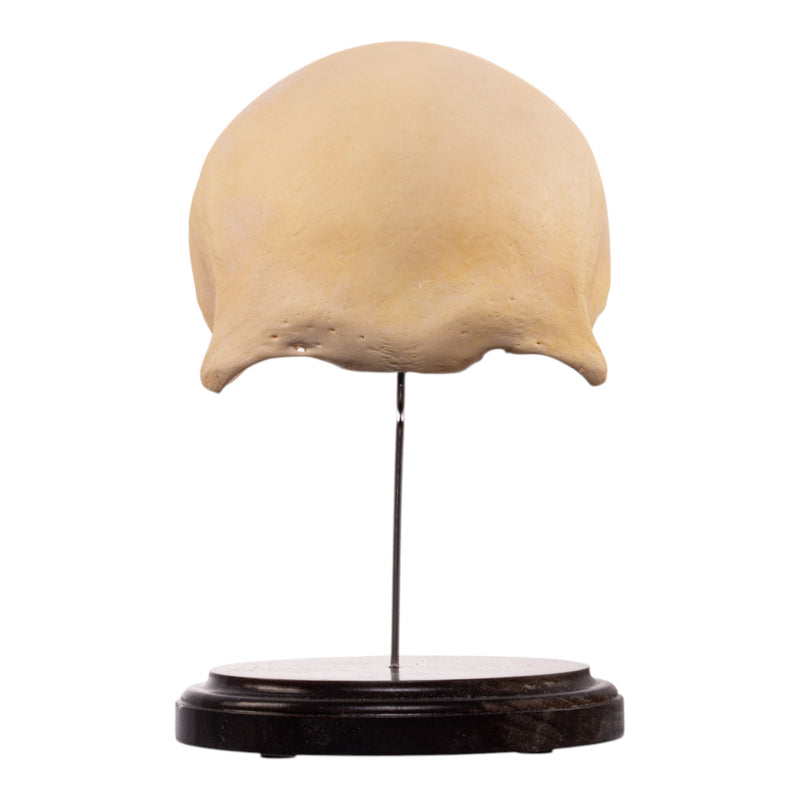 Real Human Frontal Bone on Stand