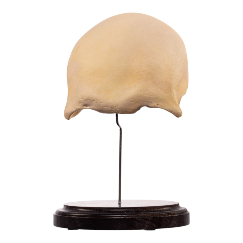 Real Human Frontal Bone on Stand