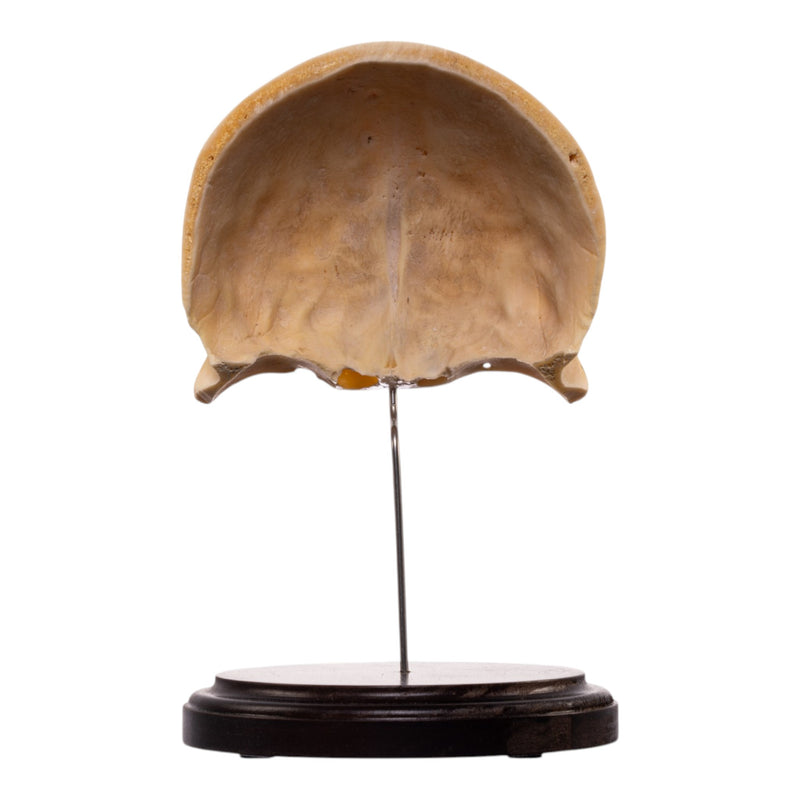 Real Human Frontal Bone on Stand